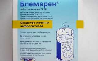 Как можно лечить оксалатные камни в почках